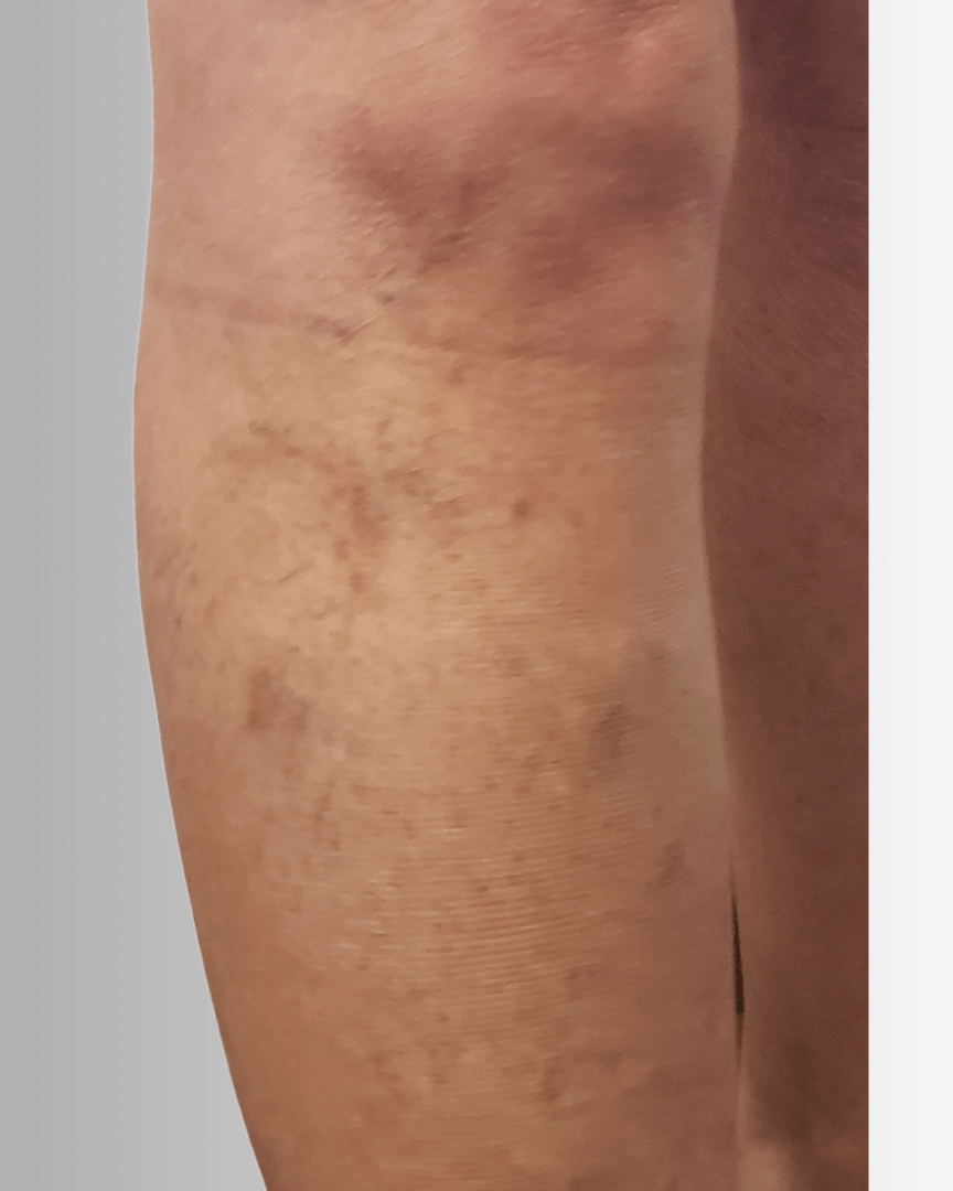 DO After Front Right Leg