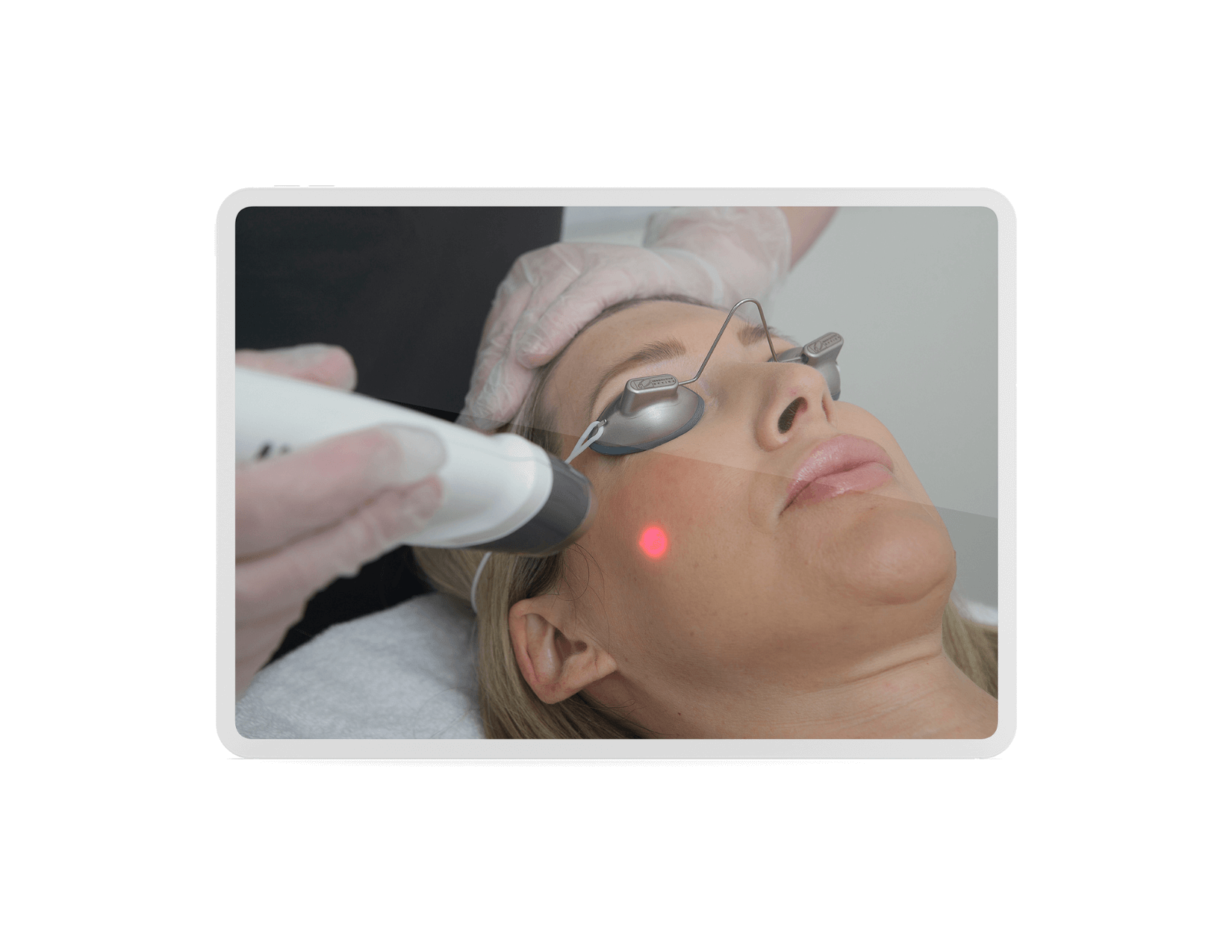 Laser Glow Facial