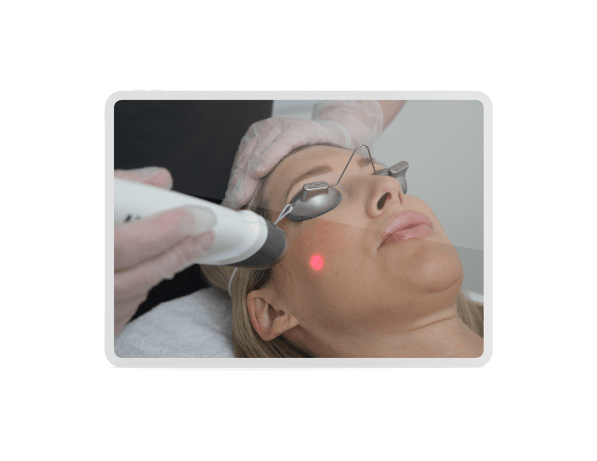 Laser Glow Facial